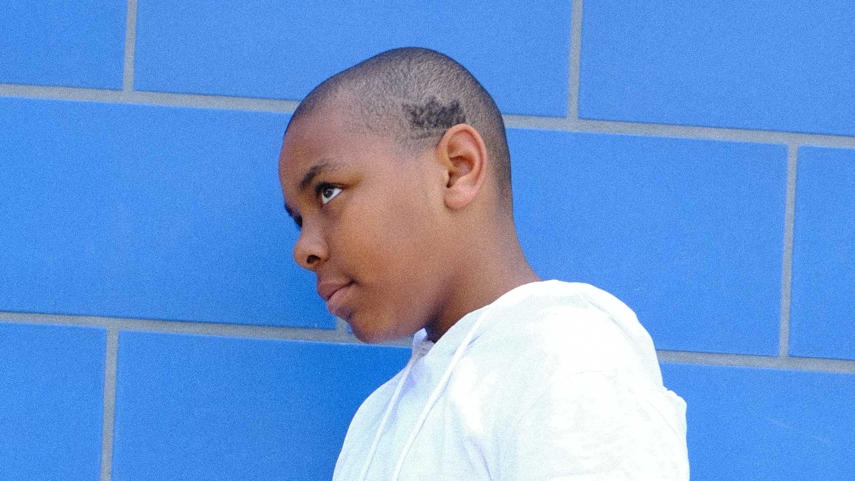 Closely cropped photo of a boy with a buzz cut that clarly shows a darker crown-shaped patch of hair above his ear.